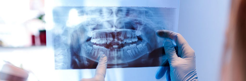 Fotografía de radiografía panorámica dental